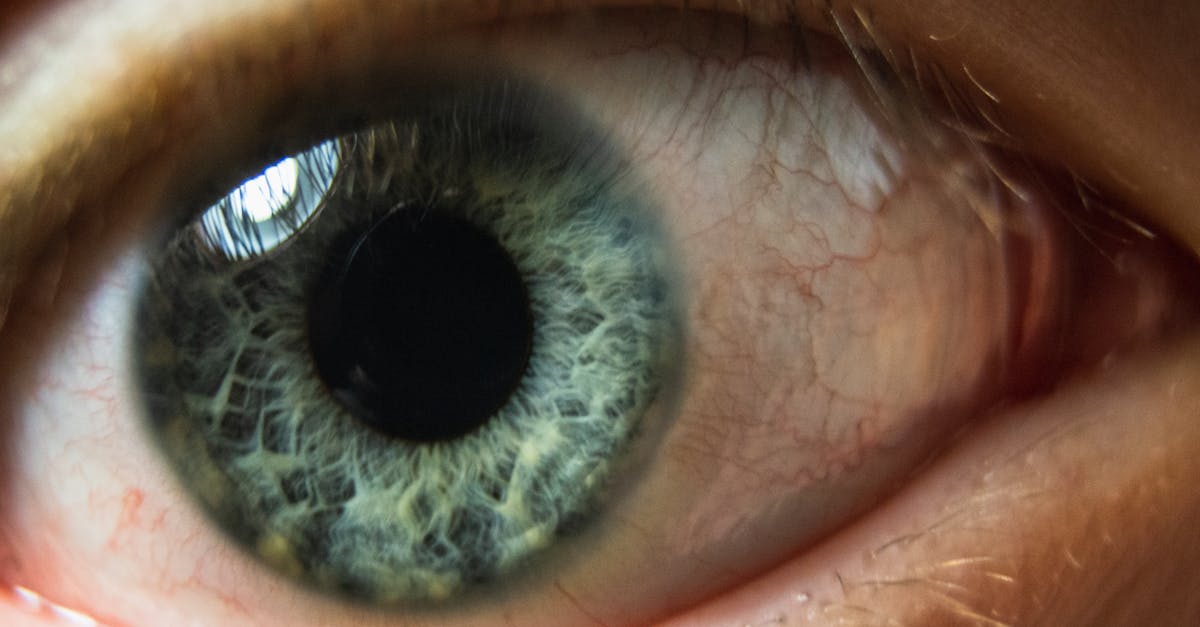 analyse de l'iris : découvrez comment étudier les caractéristiques de l'iris pour mieux comprendre la santé et la personnalité grâce à des techniques précises d'iris analysis.